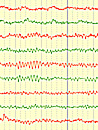 EEG, Neurologie am Lietzensee